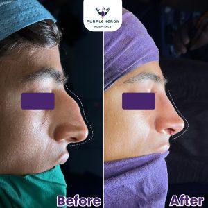 Best Plastic Surgeon in Jaipur